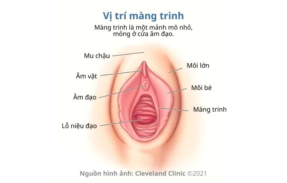 Dấu hiệu nhận biết màng trinh còn hay rách trong 4 trường hợp